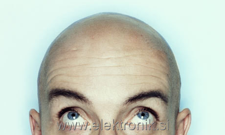 Bald-men-008.jpg